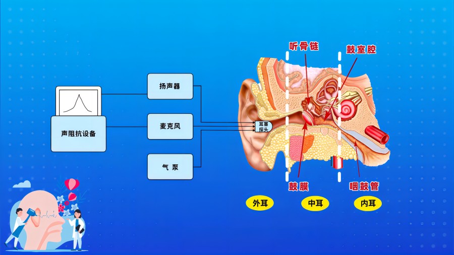 声导抗检查